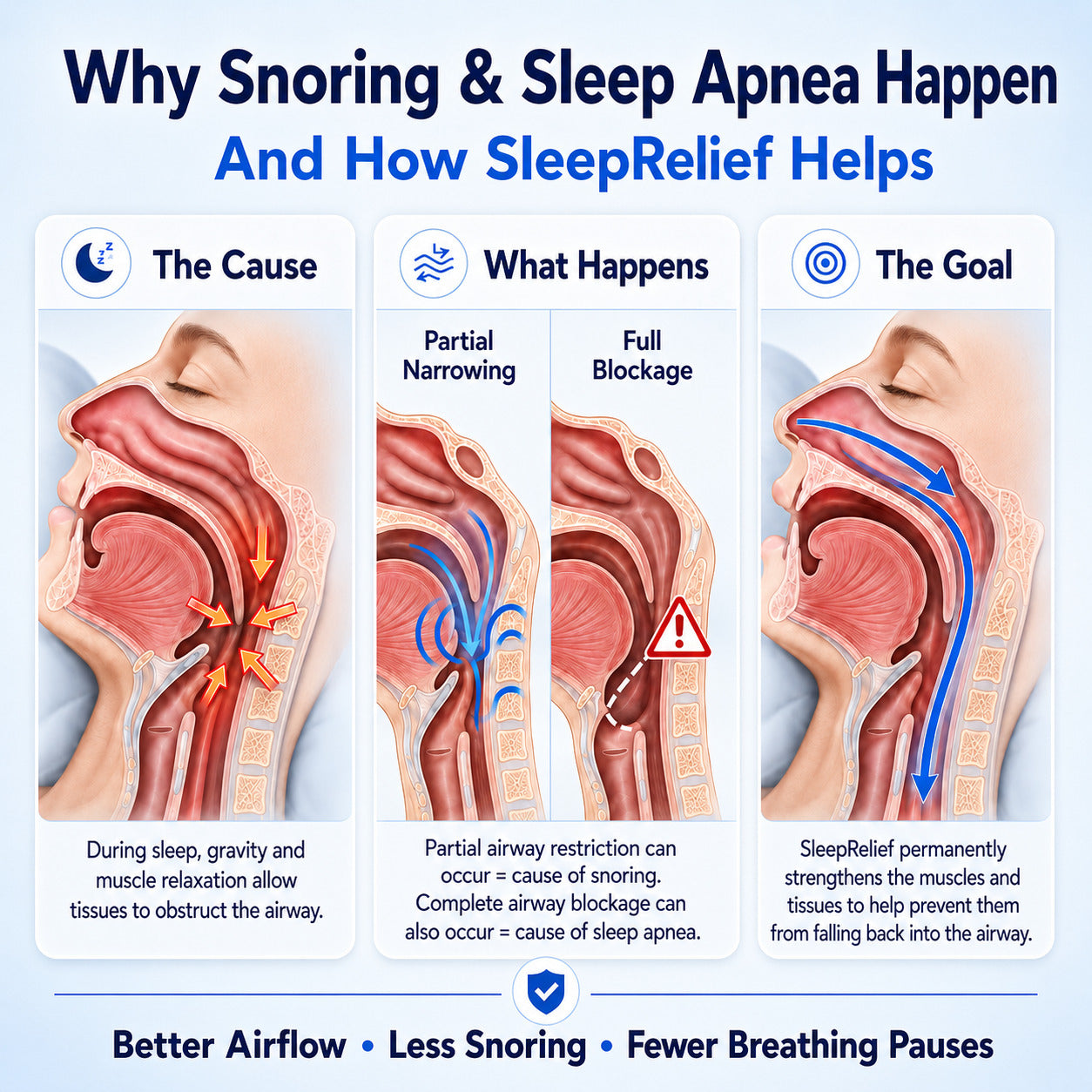 SleepRelief Pro - Stops Snoring & Sleep Apnea